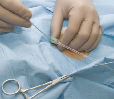 Catheterization