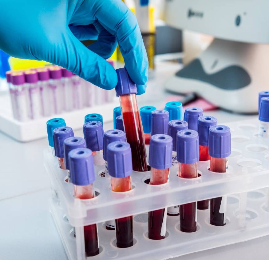 blood Test